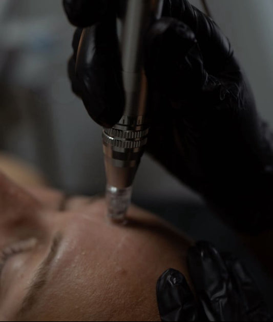 3 MICRO-NANO NEEDLING TREATMENTS